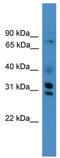 GIPC PDZ Domain Containing Family Member 3 antibody, TA344090, Origene, Western Blot image 