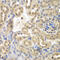 Sulfotransferase family cytosolic 2B member 1 antibody, 23-144, ProSci, Immunohistochemistry frozen image 