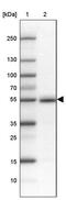 Family With Sequence Similarity 149 Member B1 antibody, PA5-58687, Invitrogen Antibodies, Western Blot image 