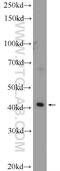 Solute Carrier Family 35 Member F2 antibody, 25526-1-AP, Proteintech Group, Western Blot image 