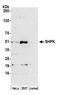 Sedoheptulokinase antibody, A305-720A-M, Bethyl Labs, Western Blot image 