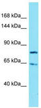 Protein turtle homolog B antibody, TA337351, Origene, Western Blot image 