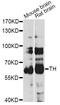 Tyrosine Hydroxylase antibody, A0028, ABclonal Technology, Western Blot image 