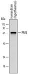 P21 (RAC1) Activated Kinase 3 antibody, AF6897, R&D Systems, Western Blot image 