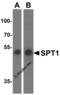 Serine Palmitoyltransferase Long Chain Base Subunit 1 antibody, 6303, ProSci, Western Blot image 