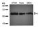 SRC Proto-Oncogene, Non-Receptor Tyrosine Kinase antibody, orb14564, Biorbyt, Western Blot image 