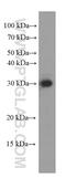 Caseinolytic Mitochondrial Matrix Peptidase Proteolytic Subunit antibody, 66271-1-Ig, Proteintech Group, Western Blot image 