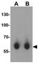 Dihydropyrimidinase-related protein 1 antibody, GTX31288, GeneTex, Western Blot image 