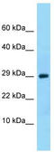 Neurotrophic factor antibody, TA342144, Origene, Western Blot image 
