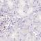 Pancreatic Lipase antibody, NBP2-38962, Novus Biologicals, Immunohistochemistry paraffin image 