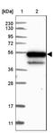 Kelch Repeat And BTB Domain Containing 4 antibody, NBP1-88587, Novus Biologicals, Western Blot image 