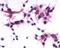 P2Y purinoceptor 1 antibody, NLS3795, Novus Biologicals, Immunohistochemistry frozen image 