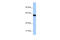 Zinc Finger Protein 350 antibody, 28-743, ProSci, Enzyme Linked Immunosorbent Assay image 