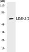 LIM Domain Kinase 1 antibody, EKC1339, Boster Biological Technology, Western Blot image 