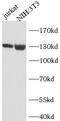 Janus Kinase 1 antibody, FNab09903, FineTest, Western Blot image 