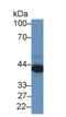 Preferentially Expressed Antigen In Melanoma antibody, LS-C296018, Lifespan Biosciences, Western Blot image 