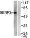 Sentrin-specific protease 2 antibody, TA315697, Origene, Western Blot image 
