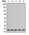 Phosphoserine Phosphatase antibody, orb341392, Biorbyt, Western Blot image 