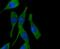 Protein Phosphatase 1 Regulatory Inhibitor Subunit 1A antibody, NBP2-67695, Novus Biologicals, Immunofluorescence image 