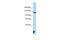 DNA Ligase 3 antibody, ARP54960_P050, Aviva Systems Biology, Western Blot image 