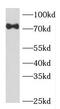 Forkhead box protein P4 antibody, FNab03210, FineTest, Western Blot image 