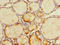 Phosphomannomutase 2 antibody, orb41204, Biorbyt, Immunohistochemistry paraffin image 