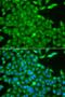 Casein Kinase 1 Gamma 2 antibody, LS-C349056, Lifespan Biosciences, Immunofluorescence image 