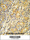 CYP51A1 antibody, 63-681, ProSci, Immunohistochemistry paraffin image 