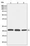 Rac Family Small GTPase 1 antibody, M00041, Boster Biological Technology, Western Blot image 
