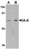 INSM Transcriptional Repressor 2 antibody, PA5-20824, Invitrogen Antibodies, Western Blot image 