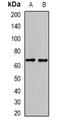 Glutamate Decarboxylase 2 antibody, LS-B15828, Lifespan Biosciences, Western Blot image 
