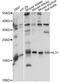 Interleukin 31 antibody, A14982, ABclonal Technology, Western Blot image 