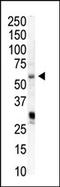 Phosphatidylinositol-4-phosphate 5-kinase type-1 alpha antibody, AP14962PU-N, Origene, Western Blot image 
