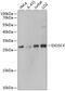 Exosome Component 4 antibody, GTX65547, GeneTex, Western Blot image 