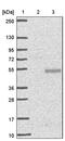 Heparan sulfate 2-O-sulfotransferase 1 antibody, PA5-60433, Invitrogen Antibodies, Western Blot image 