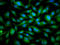 Small Nuclear Ribonucleoprotein Polypeptide E antibody, LS-C681411, Lifespan Biosciences, Immunofluorescence image 