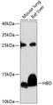 Hemoglobin subunit delta antibody, 23-816, ProSci, Western Blot image 