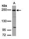 Tight Junction Protein 1 antibody, TA308455, Origene, Western Blot image 