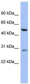 Keratin 75 antibody, TA344210, Origene, Western Blot image 