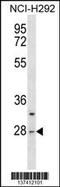 Chymotrypsin Like antibody, 60-046, ProSci, Western Blot image 