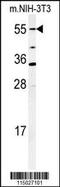 Cytochrome P450 Family 26 Subfamily A Member 1 antibody, 61-487, ProSci, Western Blot image 