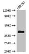 Dehydrogenase/Reductase 13 antibody, LS-C377922, Lifespan Biosciences, Western Blot image 