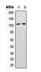 Adhesion G Protein-Coupled Receptor G3 antibody, orb393302, Biorbyt, Western Blot image 