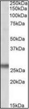 Synaptosome Associated Protein 23 antibody, orb96442, Biorbyt, Western Blot image 