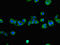 Nicotinamide N-Methyltransferase antibody, orb46867, Biorbyt, Immunocytochemistry image 