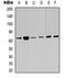 5 -AMP-activated protein kinase catalytic subunit alpha-2 antibody, orb323215, Biorbyt, Western Blot image 