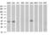 Malonyl CoA-acyl carrier protein transacylase antibody, M04806, Boster Biological Technology, Western Blot image 