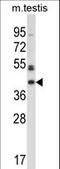 Protein O-Mannose Kinase antibody, LS-C164573, Lifespan Biosciences, Western Blot image 