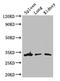 AlkB Homolog 4, Lysine Demethylase antibody, LS-C502023, Lifespan Biosciences, Western Blot image 