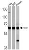 Forkhead Box O1 antibody, AHP2400, Bio-Rad (formerly AbD Serotec) , Western Blot image 